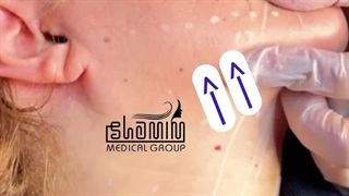 دکتر ایرج شهنوازی ترمیم سوختگی